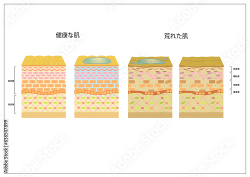 肌断面