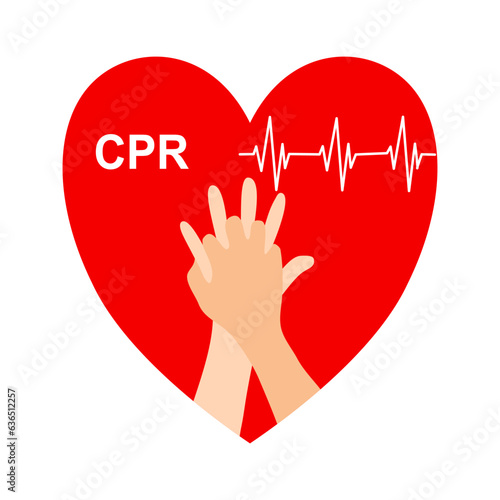 Cardiopulmonary resuscitation (CPR) is a lifesaving technique that's useful in many emergencies in which someone's breathing or heartbeat has stopped