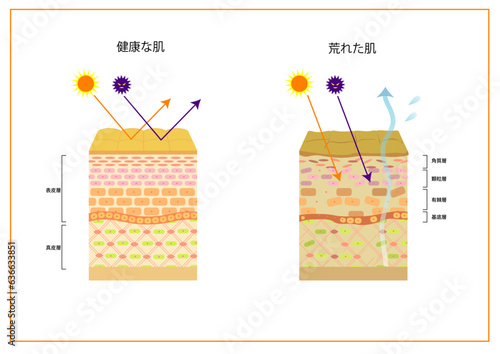 肌バリア