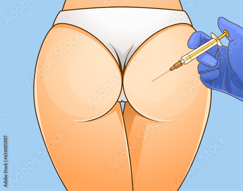 Beauty injections. Non-surgical correction. Injection for bigger buttocks. Healthcare illustration. Beauty illustration. Vector illustration. 