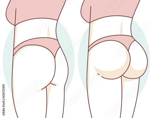 Non-surgical correction. Before, after. Healthcare illustration. Beauty illustration. Vector illustration. 