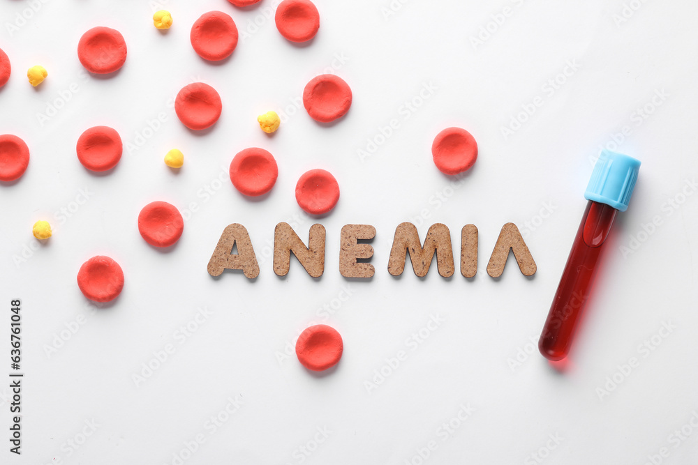 Red blood cells model and word anemia, test tube on white background