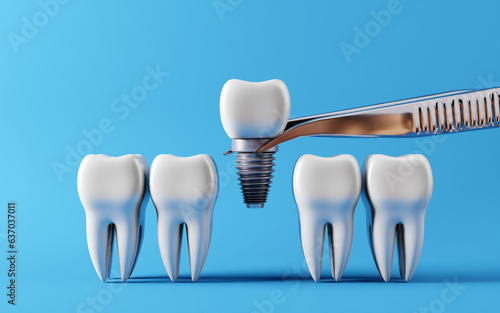 Dental teeth implants and Healthy white tooths. Oral health and dental inspection teeth. Medical dentist tool, children healthcare, 3D render