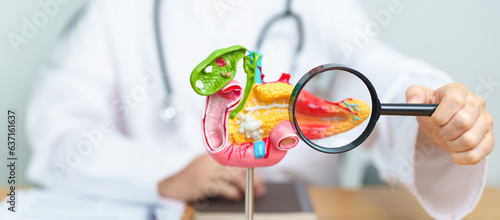 Doctor with human Pancreatitis anatomy model with Pancreas, Gallbladder, Bile Duct, Duodenum, Small intestine and magnifying glass. Pancreatic cancer, acute pancreatitis and Digestive system