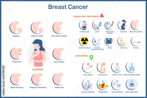 medical infographic ,Vector illustration of breast cancer in flat style.Symptoms of breast cancer Causes and risk factors for breast cancer How to prevent breast cancer.isolated on white background