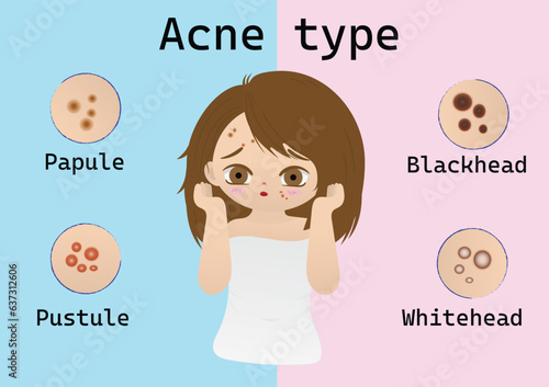 cartoon vector about facial skin problems, cartoon beautiful