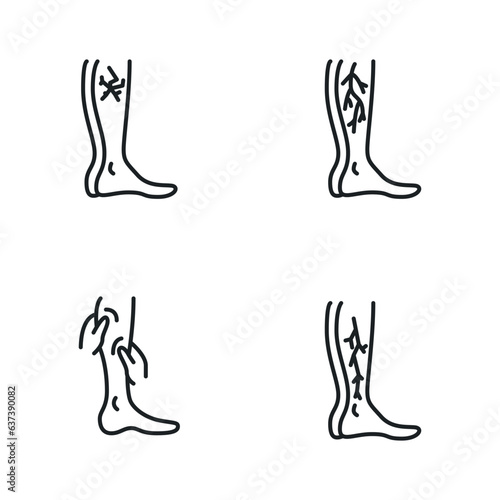 Varicose treatment icons, leg veins thrombosis disease and surgery vector symbols. 