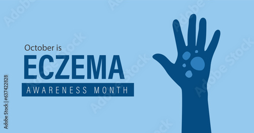 National Eczema Awareness Month banner. Observed in October annually. Flat vector design.