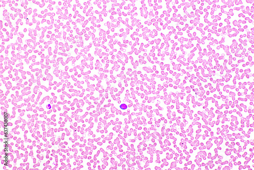 Red blood cells and white blood cells in blood smear, Wright-Giemsa stain, analyze by microscope, 10x photo