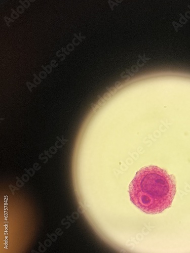 Crytpococcus neoformans encapsulated organism inside macrophage photo