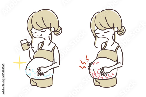 妊娠線ができてしまった女性とケアをしてきれいなお腹の女性のイラスト