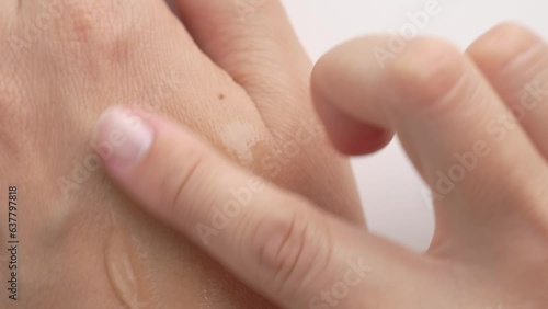 Female hands care. Close up of woman applying serum gel on hand skin. Serum oil with hyaluronic acid applied by a woman's hand, skin care cosmetics, moisturizing gel.