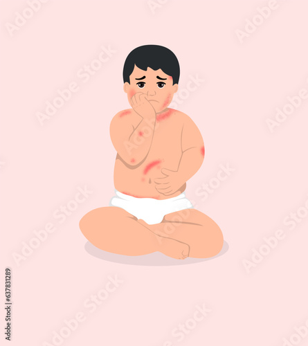 Sick Baby with a rash