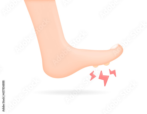 Clavus disease. There is a fisheye lump on the sole of the foot. nodules on the leg are painful or aching. health issues. Minimalist 3D illustration design. vector elements. white background