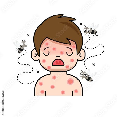 The child has red rashes on his body. Due to being bitten by a mosquito to dengue fever.