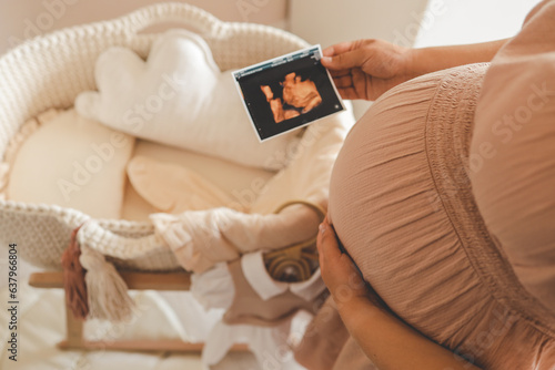Ultrasound picture pregnant baby photo. Woman holding ultrasound pregnancy image. Concept of pregnancy, maternity, expectation for baby birth photo