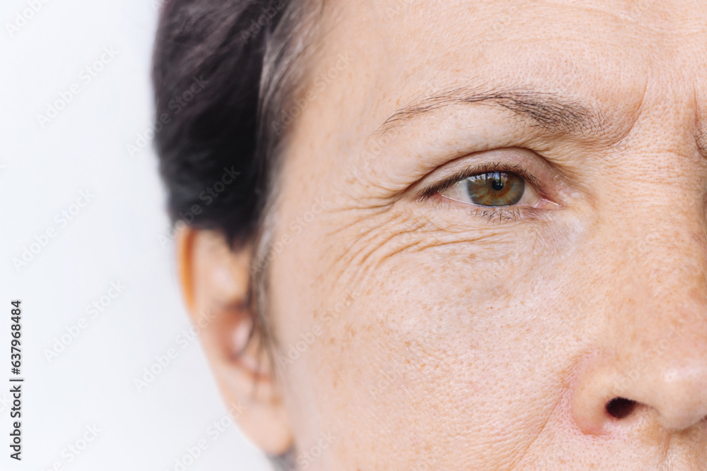 Cropped shot of an elderly caucasian woman's face with puffiness and facial wrinkles under her eyes isolated on a white background. Age-related skin changes, fatigue. Cosmetology and beauty concept