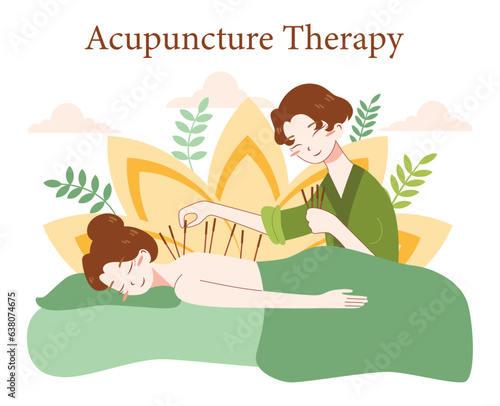 Acupuncture. Needle therapy, asian alternative medicine. Chinese medical