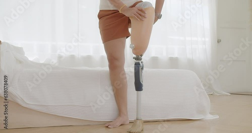 Happy Disabled Asian woman amputee walking take a rest and takes off removing prosthetic leg while sitting on bed. Leg prosthetic equipment, Amputee concept photo