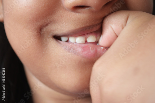  child girl biting her nails at home,