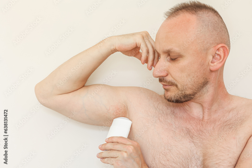 Young man with irritation, inflammation on sensitive underarm skin