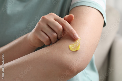 Woman applying ointment onto her arm indoors, closeup