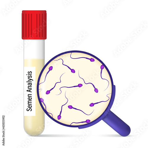 Semen analysis. Sperm in a test tube and a magnifying glass with sperm. Male infertility.