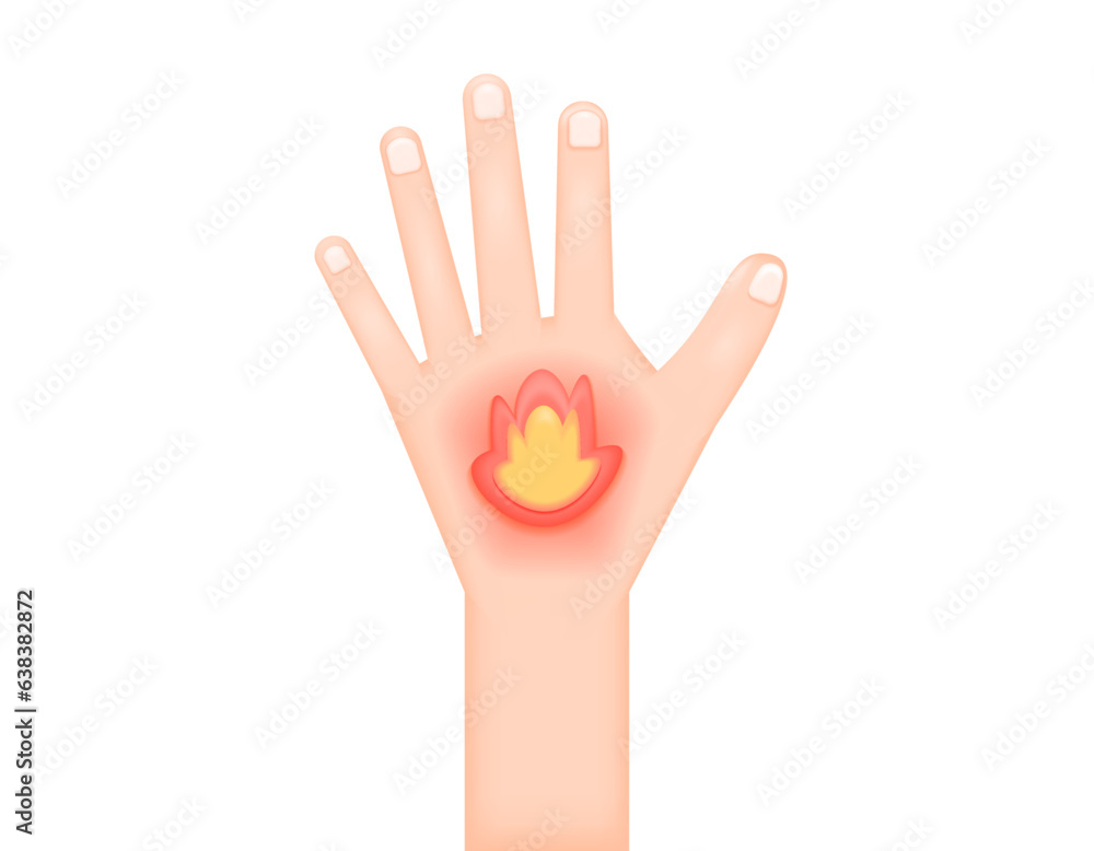 Obraz premium Heat in the hands. Hands ache, pain, and heat like burning. symptoms of the disease. problems or disorders in the muscles or nerves. health problems. Minimalist 3D illustration design. vector elements