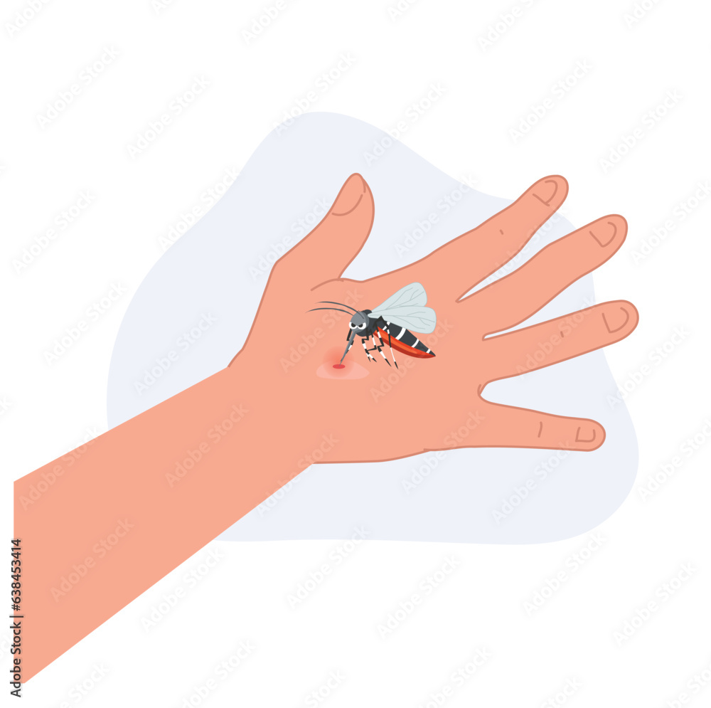 A cartoon illustration of mosquito on human hand sucking blood. A cartoon illustration of mosquito on human hand sucking blood.