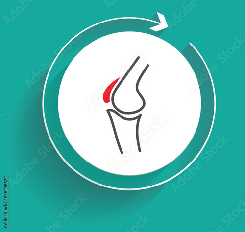 Knee damage can also occur from underlying disease such as osteoarthritis, rheumatoid arthritis and systemic lupus erythematosus