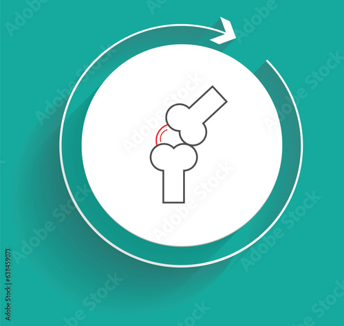 Structural abnormalities or traumas, including car accidents, falls, and contact sports, can cause a knee dislocation