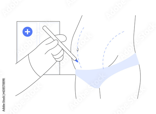Abdominoplasty abstract concept vector illustration.