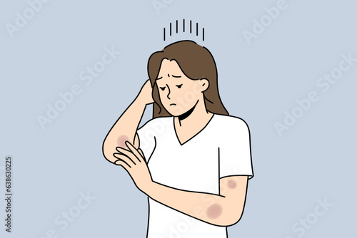 Woman with bruises on arms is sad and looks at abrasions received after fall or accident on road. Depressed girl needs healing ointment for bruises and wounds left due to domestic violence