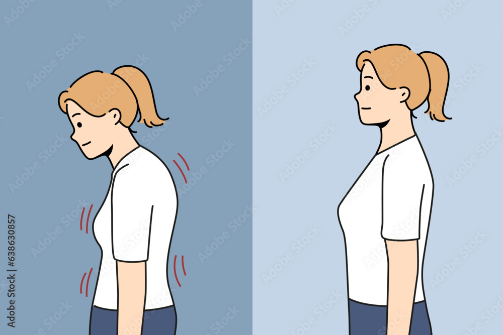 Stooped woman before and after correcting posture thanks to massage therapist or chiropractor helping to get rid of scoliosis. Girl with bad posture due to lordosis and kyphosis or spinal defect Stooped woman before and after correcting posture thanks to massage therapist or chiropractor helping to get rid of scoliosis. Girl with bad posture due to lordosis and kyphosis or spinal defect