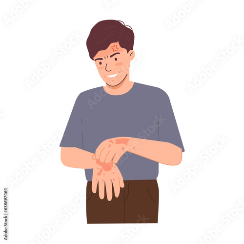 Man scratching his hand with skin disease problem. Rash on hands from scratching. Eczema on the wrist, dry skin. Hand drawn vector character illustration. Isolated on white background.