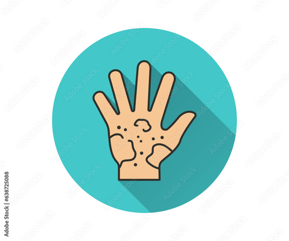 Eczema flat icon with long shadow for graphic and web design. Eczema flat icon with long shadow for graphic and web design.