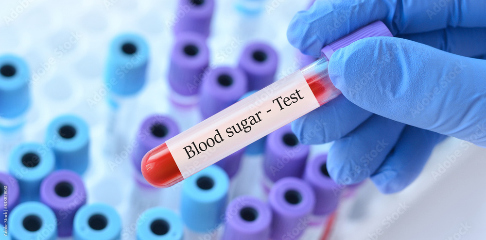 Obraz premium Doctor holding a test blood sample tube with Sugar test on the background of medical test tubes with analyzes.Copy space for text