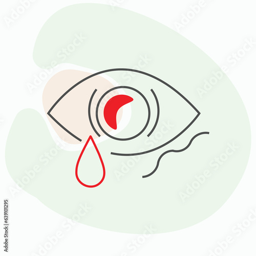 Dry eye syndrome, also known as keratoconjunctivitis sicca or dry eye disease, is a common condition that occurs when the eyes do not produce enough tears or when the tears evaporate too quickly photo