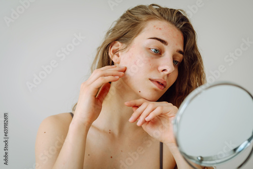 Принти на полотні Beautiful woman with problematic skin looks in her small mirror