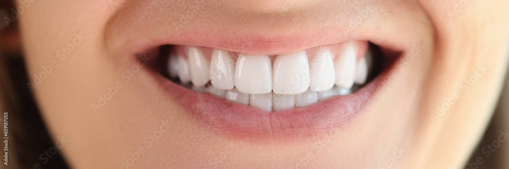 Obraz premium Close-up of female showing healthy smooth white teeth.