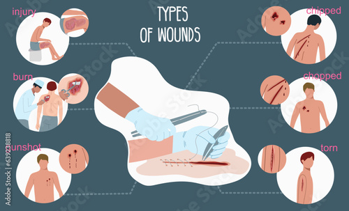 Types Of Wounds Infographics photo