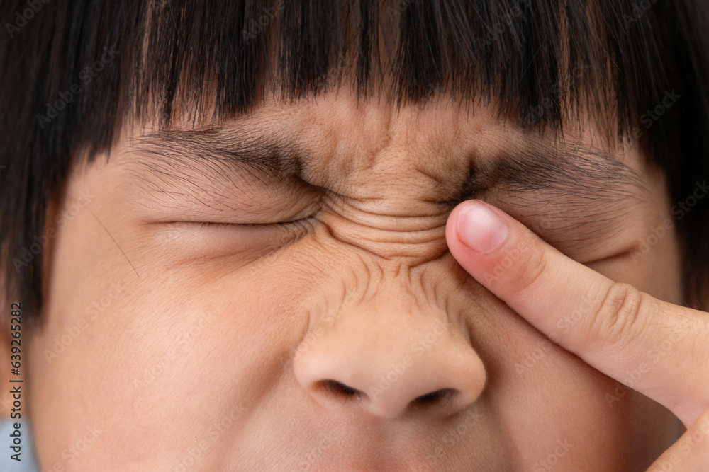 Little girl allergic to dust rubs her eyes close-up. Little girl itchy his eyes with tear. Little girl allergic to dust rubs her eyes close-up. Little girl itchy his eyes with tear.