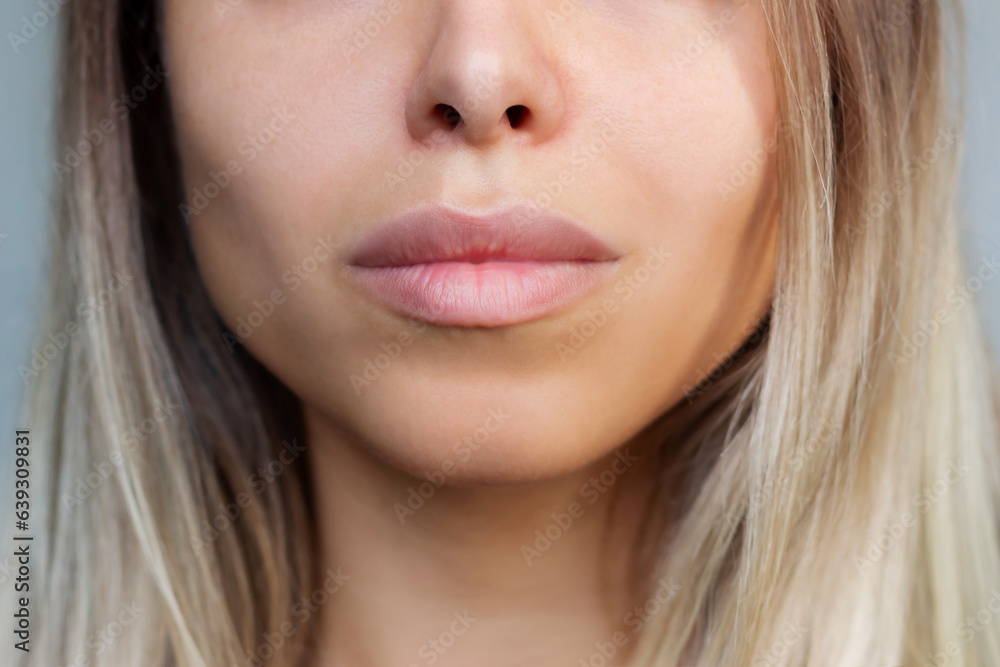 Cropped shot of young caucasian blonde woman's face with perfect lips after lip enhancement. Injection of filler in lips on a gray background. The result of lip augmentation. Close up Cropped shot of young caucasian blonde woman's face with perfect lips after lip enhancement. Injection of filler in lips on a gray background. The result of lip augmentation. Close up
