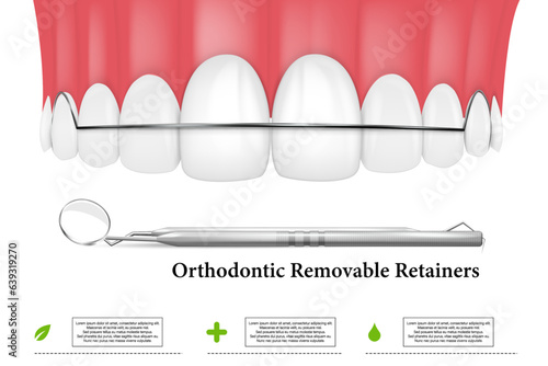 3d render of jaw with orthodontic removable retainer over whte background