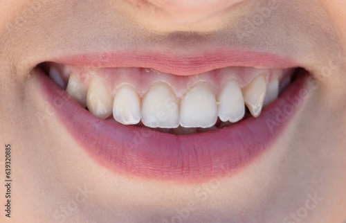 Lips and teeth of a smiling girl. Macro