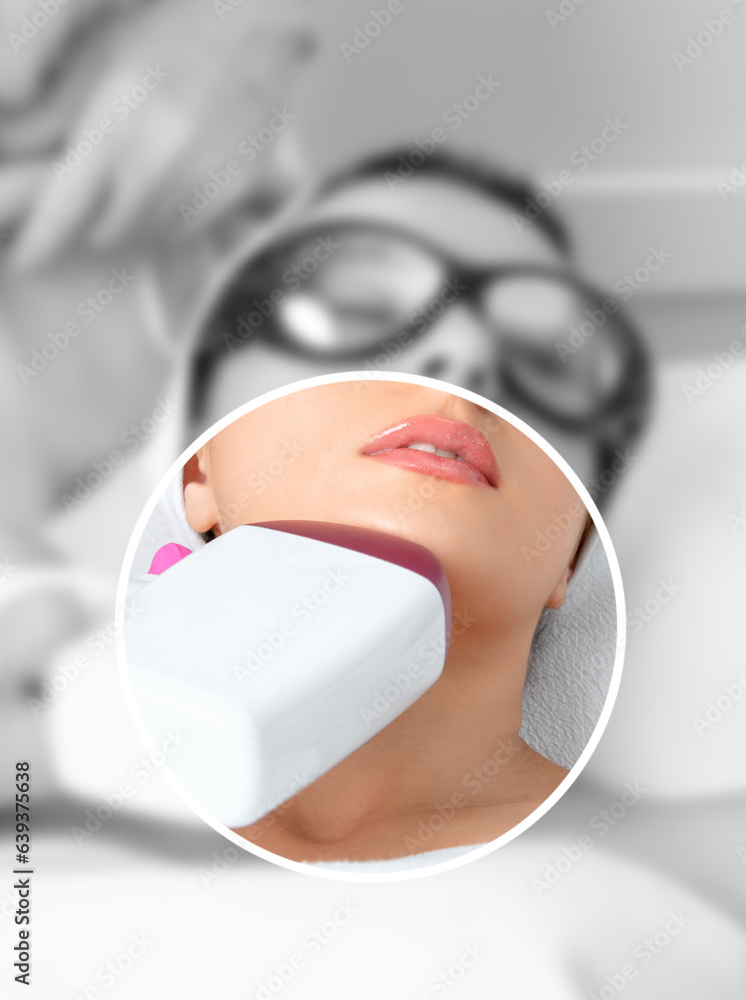 Naklejka premium Elos epilation hair removal procedure on the face of a woman. Beautician doing laser rejuvenation in a beauty salon. Facial skin care. Hardware ipl cosmetology