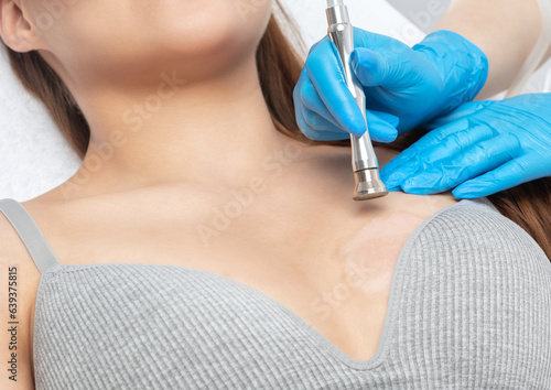 The cosmetologist makes a microdermabrasion procedure on the skin of the chest after a burn of a young woman in a beauty salon. Cosmetology and professional skin care.
