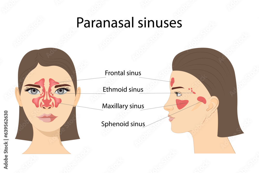 paranasal-sinuses-frontal-ethmoidal-sphenoidal-and-maxillary