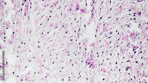 White fibrous tissue of human being filmed under microscope 200x on bright field background. Isolated macro of dense regular connective layers consisting of fibroblasts and having strong structure. photo