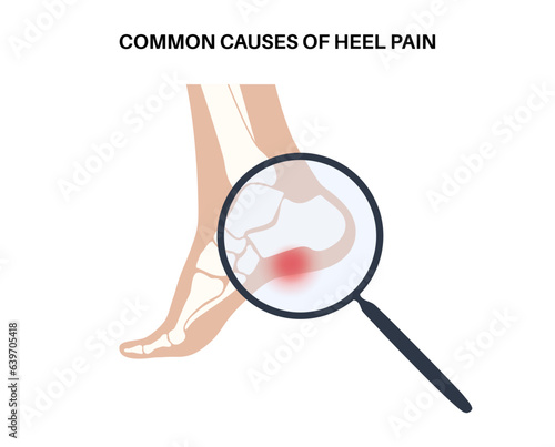 Pain of the heel